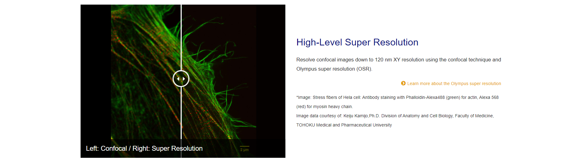 超高分辨率转盘共聚焦显微镜(图2)